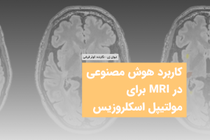 تصویر MRI مغز در تشخیص مولتیپل اسکلروزیس با هوش مصنوعی تیوان ژن