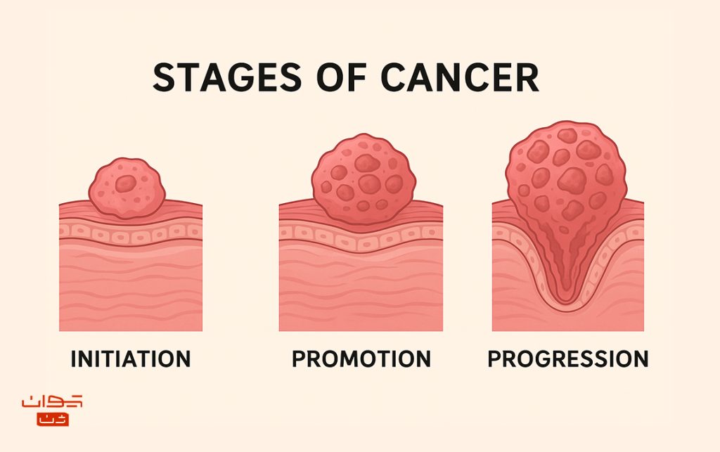 Stages_Of_Cancer مراحل_سرطان