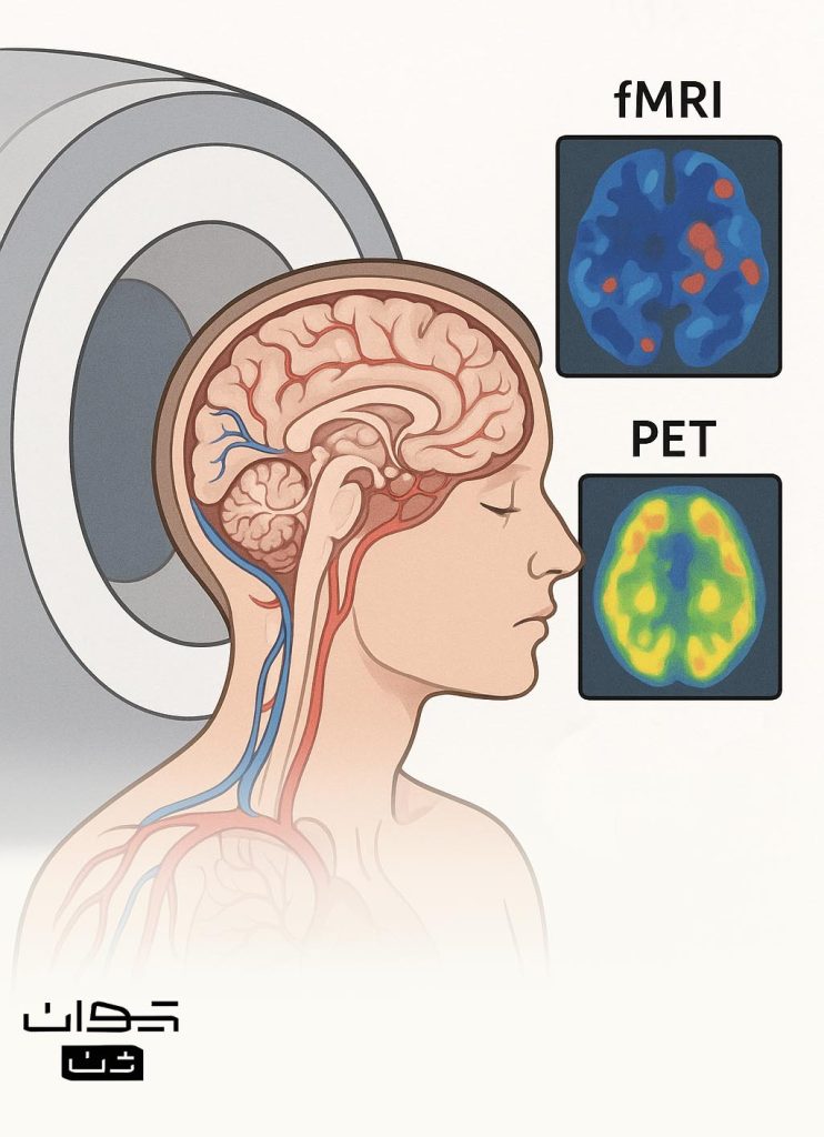 fMRI & PET