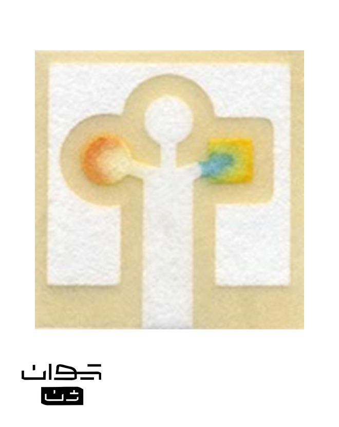 شکل 12 | تراشه تشخیصی کاغذی برای اندازه‌گیری غلظت گلوکز (سمت چپ) و پروتئین (سمت راست) ادرار (منبع: MIT Technology Review)